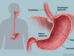 Puluhan Warga Di Ulu Lapaopao “Tiba – Tiba” Terserang Wasir
