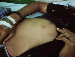 Terkena Peluru Nyasar, Siswa SMA di Baubau Dilarikan di RSUD