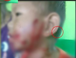 Anjing Gila Kembali Menyerang Warga di Kolut, Bocah Jadi Korban