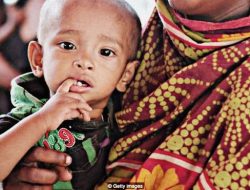 DINKES BAUBAU 2019 : Anak Cenderung Lebih Kerdil Dibanding Anak Sesuisianya, Kenapa?