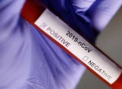 Update Terbaru Covid-19 di Muna Pertanggal 1 April 2020