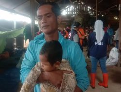 Tinggal Digudang Penggilingan, Balita Penderita Hoenger Oedema Butuh Uluran Tangan Dermawan